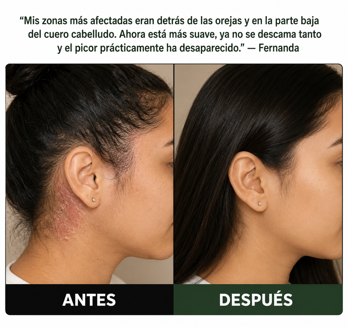 Exfoliante Capilar Natural Mertuka